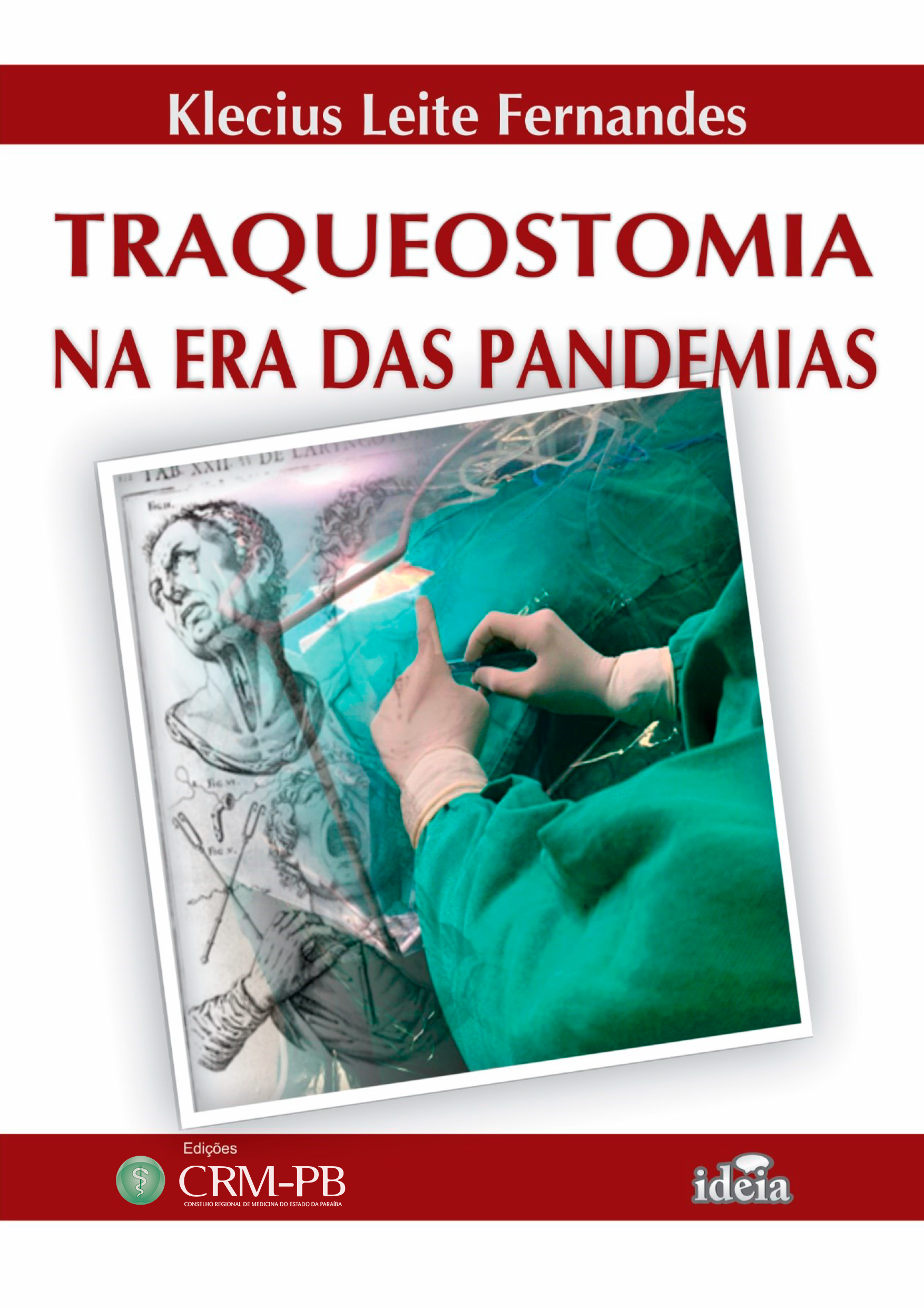 ebook traqueostomia